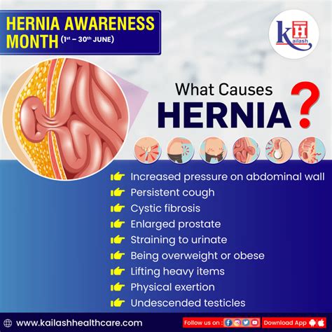 hernia occurs   organ pushes   opening   muscle  tissue  holds