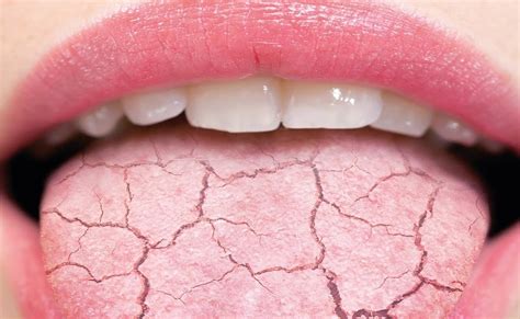 chingum — discover curiosities the cracks on the tongue and is it