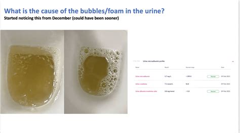 foamy urine   abnormal protein developed