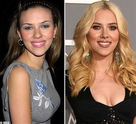 scarlett johansson nose job before and after scarlett johansson scarlett johansson