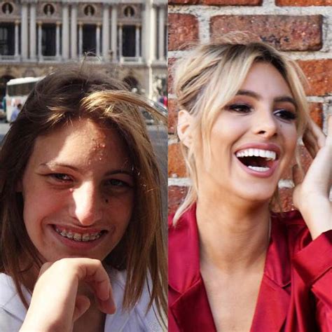 This Instagram Model Is An Example Of How Plastic Surgery