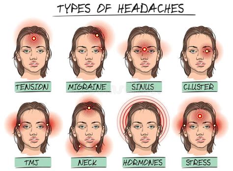 headache types stock vector illustration  resolution