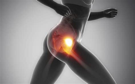 whats causing  snapping hip syndrome clinical somatics