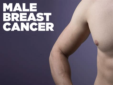 can men get breast cancer upmc health plan