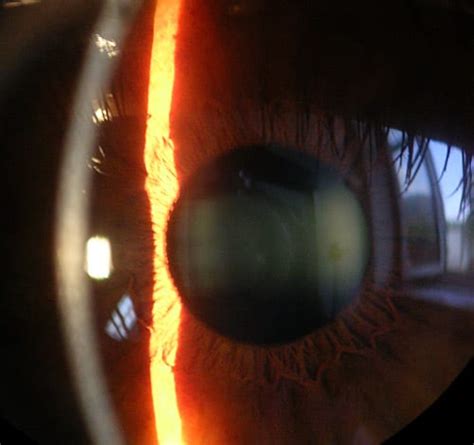 human cornea  layer  discovered