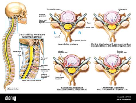 nerve root  res stock photography  images alamy