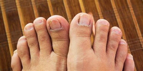 weird things that can happen to your toenails and feet
