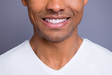 dentist whiten  teeth teeth whitening  pomona