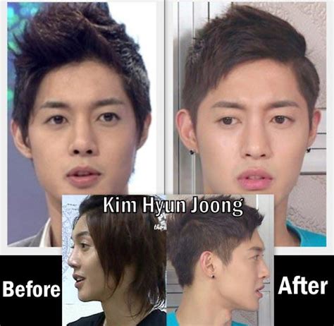 Basic Information About The Why Korean Plastic Surgery Is