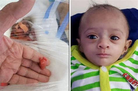 worlds smallest baby asia manushi survives  weighing