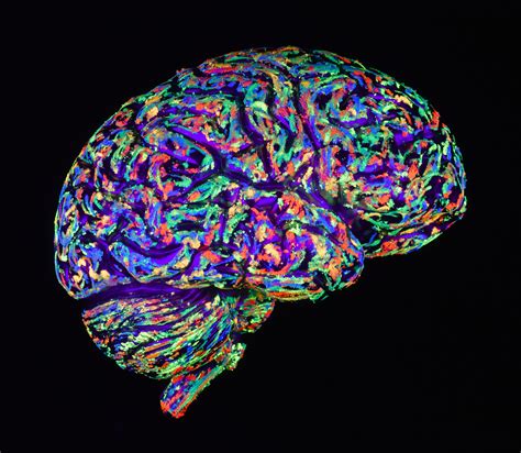 sensory processing disorder linked  brain structure differences huffpost
