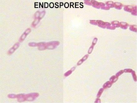 bacterial morphology