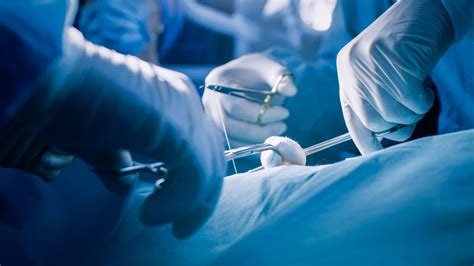 gigantycznego guza usuneli pacjentce lekarze ze swidnicy guz jajnika