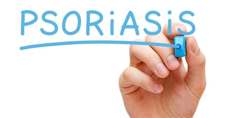 es la psoriasis