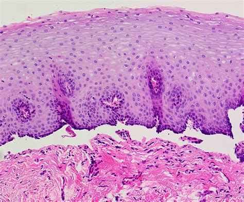 Mucous Membrane Histology