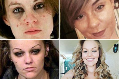 former drug addicts share incredible transformation photos