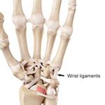 wrist pain injuries whats causing  wrist pain