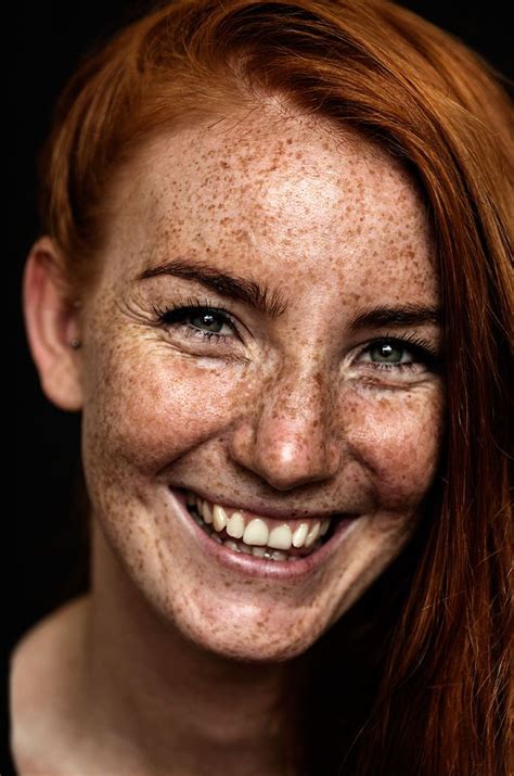 98 Freckled People Who’ll Hypnotize You With Their Unique