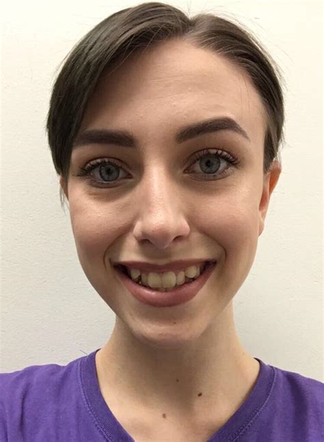 How To Fix A Crooked Smile Reddit B A Front Facing Neutral Expression
