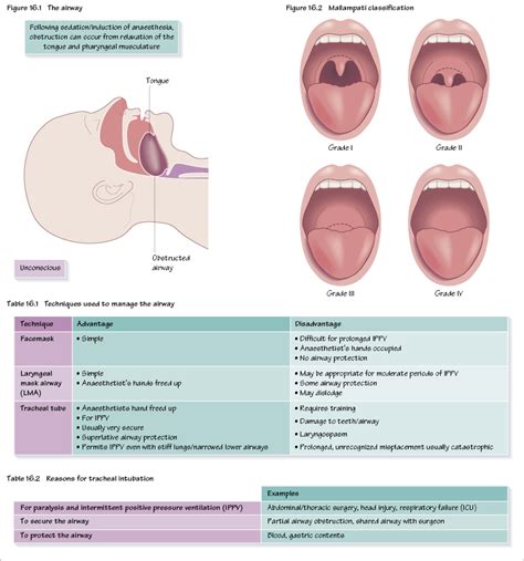 airway pocket dentistry