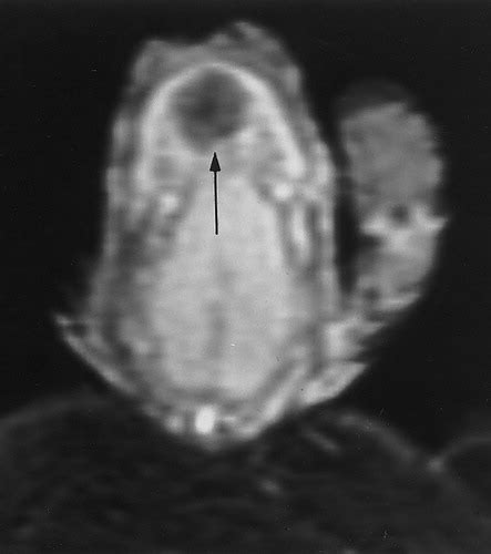 mr imaging of the penis radiographics