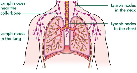 The Lungs Lung Cancer Macmillan Cancer Support