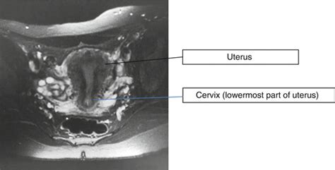 Anatomy And Physiology Of Cervix Obgyn Key