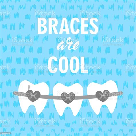 Braces On Teeth Are Cool Vector Illustration Dental Braces Braces Teeth