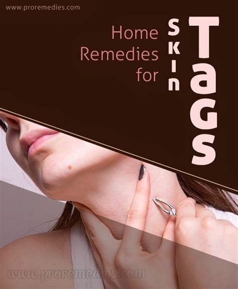 home remedies for skin tags home remedies for skin home remedies
