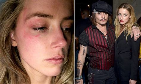 amber heard granted restraining order after accusing johnny depp of domestic violence daily