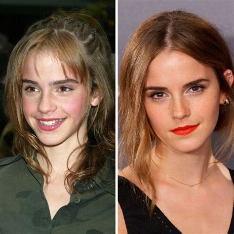 the beauty evolution of emma watson from bare faced