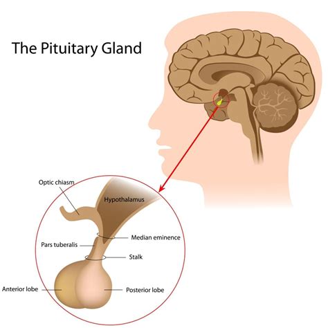 pituitary tumors