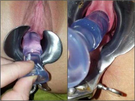 download speculum porn video clips for free rare amateur fetish video