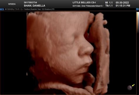 bellies ultrasound pregnancy spa orlando  eastgate dr