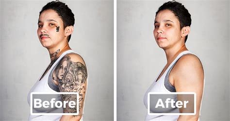 9 Ex Gang Members With Their Tattoos Removed Bored Panda
