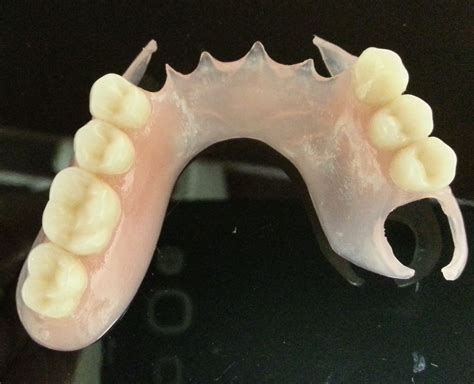 partials dogwood dental