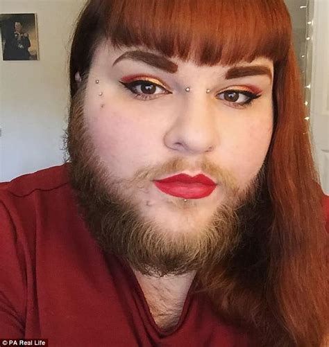 woman with pcos grows a full beard after finding love