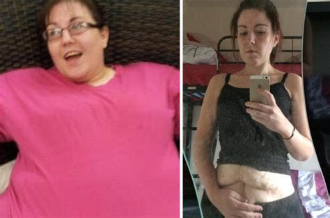 gastric band surgery failed kelly urey who says she was