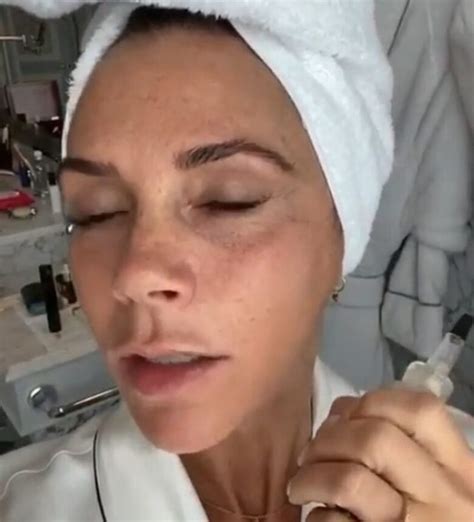 Victoria Beckham Shows Of Her Adorable Freckles Demotix