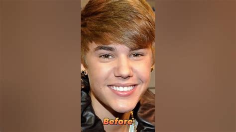 justin bieber before after youtube