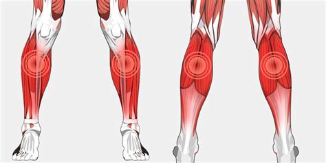 Lower Leg Pain The Complete Injury Guide Vive Health