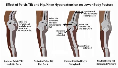 Psoas Talk With Christye — Volt Blog