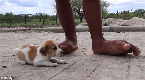 brazilian woman born with huge feet from elephantiasis dreams of heels
