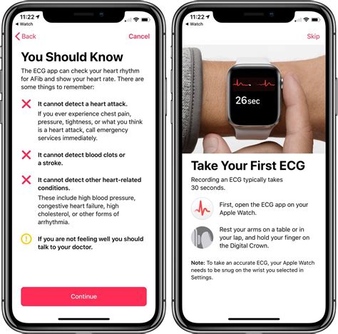 How To Take An Ecg Electrocardiogram On Apple Watch [gallery] 9to5mac