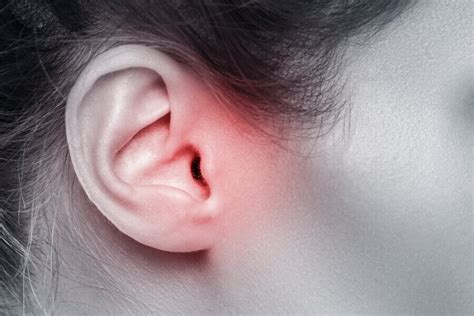 bol ucha przyczyny objawy leczenie lekarzebezkolejki