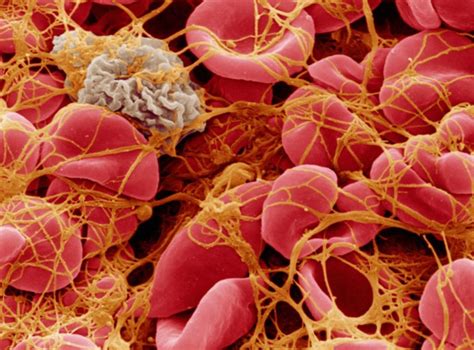 platelets         blood