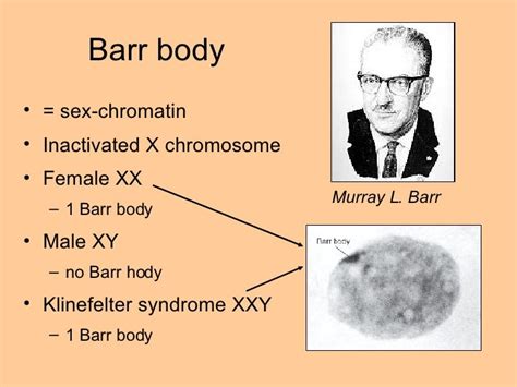 Barr Bodies In Klinefelter Syndrome Quotes Type