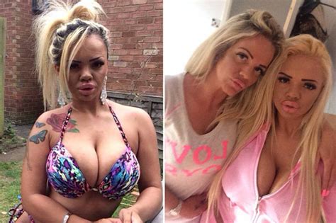 Mum And Daughter Spend £56k On Plastic Surgery To Look