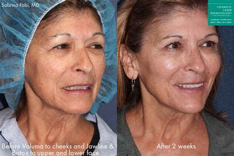 aging skin san diego ca cosmetic laser dermatology