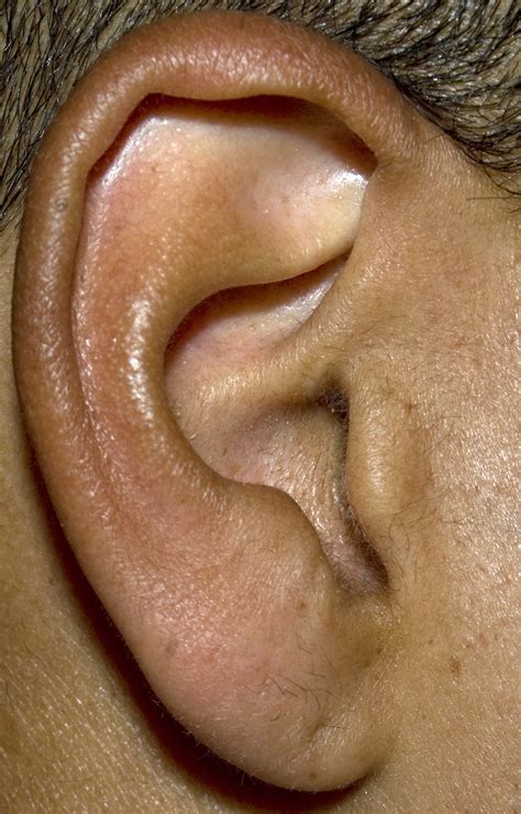 ear training ear training